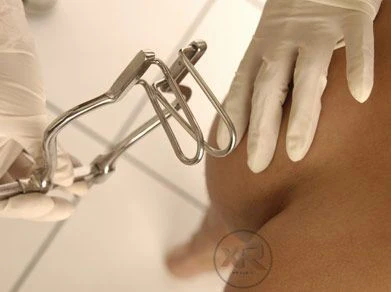 Anal Spreader - Image 3