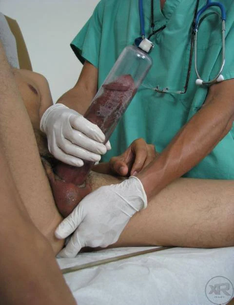 Premium Penis Pumping Set - Image 4
